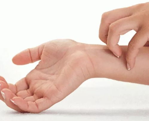 方法一：涂抹醋