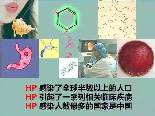 幽门螺杆菌反复感染，四环素和呋喃唑酮联合用药Neng否拯救我的胃？