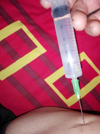 先来说说什么是注射用水
