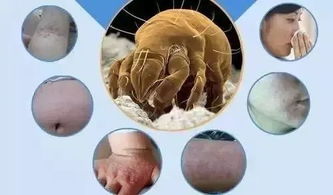 螨虫的恐怖， 并非无懈可击