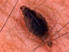 鸡虱子虫的奇妙世界