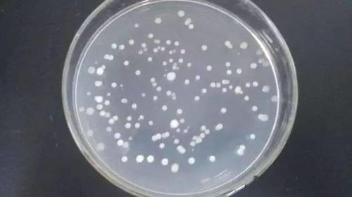 这细菌有什么特别的地方吗？