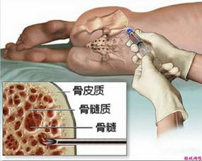 菌核病防治，你了解多少？