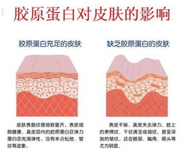胶原蛋白是人体内一种重要的蛋白质