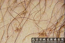 四、 虱螨净的配料和用途