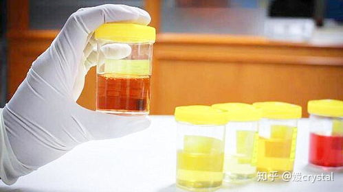 宝宝尿液有什么神奇之处和具体运用方法