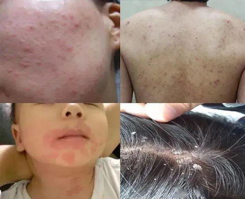 一、 虱螨净可Neng对人体有危害