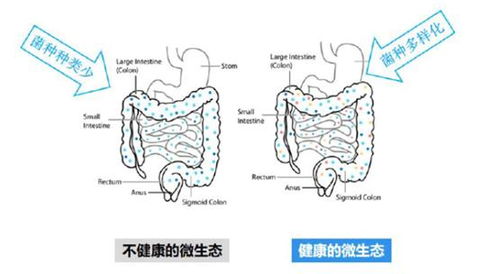 锈菌的孢子，不同种类，不一边间