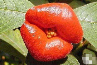 抢救过沈阳冻伤案例：