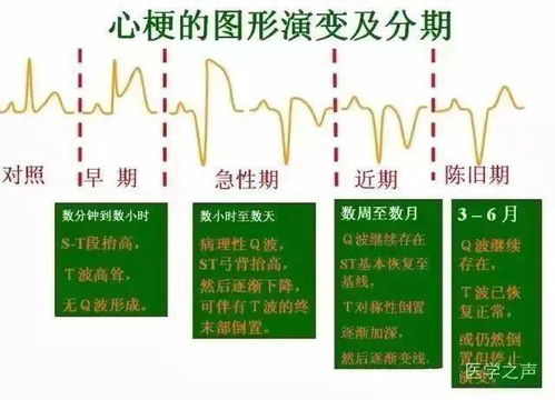 法师养护入门：秋天是黄金时期