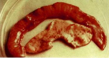 如何快速区分产房仔猪腹泻是轮状病毒还是球虫病