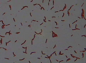 六、 巨大芽孢杆菌，土壤的“清洁工”