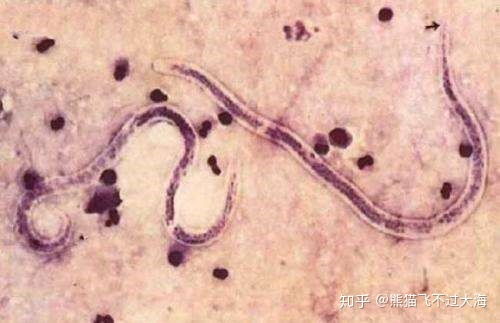养薄荷如何避免虫子侵扰？有效驱虫方法有哪些