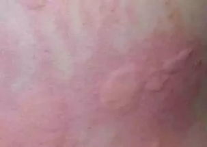 还用不用上医院啊？