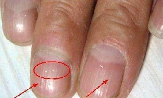 纹枯病，它的症状你认得吗？