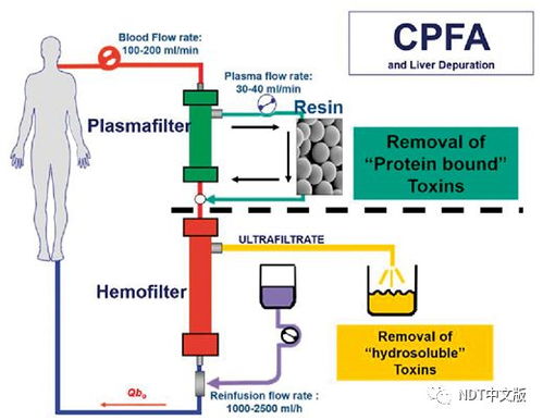 灌肠、活性炭吸附
