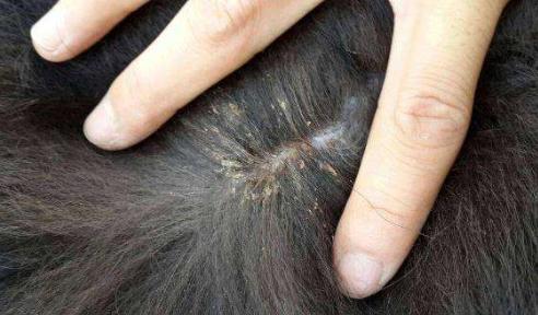 如何彻底消灭虱子？