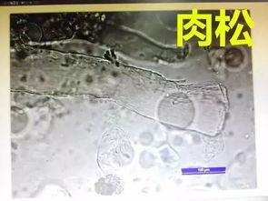 夜深了棉铃虫来袭，怎么办？