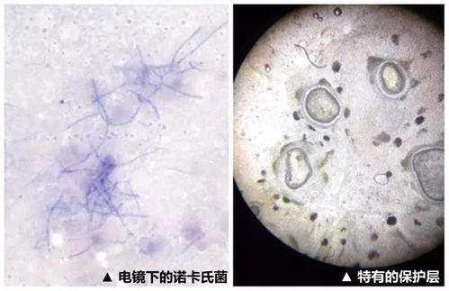 诺卡氏菌病是黑鱼养殖常见病，由诺卡氏菌引起